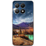 Чохол BoxFace Xiaomi 15T 