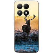 Чохол BoxFace Xiaomi 15T 