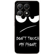 Чохол BoxFace Xiaomi 15T Don't Touch my Phone