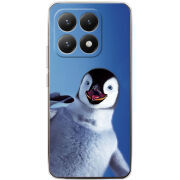 Чохол BoxFace Xiaomi 15T 