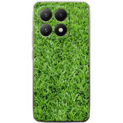 Чохол BoxFace Xiaomi 15T 