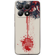 Чохол BoxFace Xiaomi 15T 