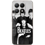 Чохол BoxFace Xiaomi 15T 