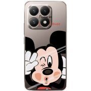 Прозорий чохол BoxFace Xiaomi 15T Mister M