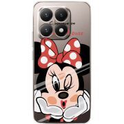 Прозорий чохол BoxFace Xiaomi 15T Lady M