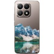 Прозорий чохол BoxFace Xiaomi 15T Blue Mountain