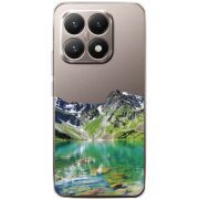 Прозорий чохол BoxFace Xiaomi 15T Green Mountain