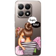 Прозорий чохол BoxFace Xiaomi 15T Super Mama and Daughter