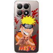 Прозорий чохол BoxFace Xiaomi 15T Naruto