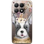 Прозорий чохол BoxFace Xiaomi 15T 