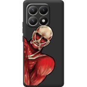 Чорний чохол BoxFace Xiaomi 15T Титан