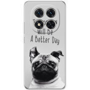 Чохол BoxFace Xiaomi Redmi Note 15 Pro Plus 