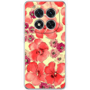 Чохол BoxFace Xiaomi Redmi Note 15 Pro Plus 