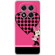 Чохол BoxFace Xiaomi Redmi Note 15 Pro Plus 