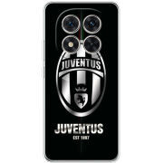 Чохол BoxFace Xiaomi Redmi Note 15 Pro Plus 