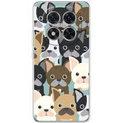 Чохол BoxFace Xiaomi Redmi Note 15 Pro Plus 