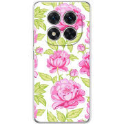 Чохол BoxFace Xiaomi Redmi Note 15 Pro Plus 