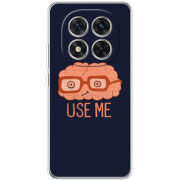 Чохол BoxFace Xiaomi Redmi Note 15 Pro Plus 