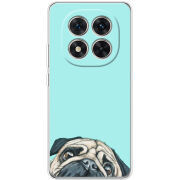 Чохол BoxFace Xiaomi Redmi Note 15 Pro Plus 