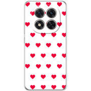 Чохол BoxFace Xiaomi Redmi Note 15 Pro Plus 