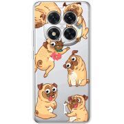 Прозорий чохол BoxFace Xiaomi Redmi Note 15 Pro Plus с 3D-глазками Pug
