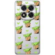 Прозорий чохол BoxFace Xiaomi Redmi Note 15 Pro Plus Pattern Baby Yoda