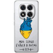 Прозорий чохол BoxFace Xiaomi Redmi Note 15 Pro Plus Моє серце в ритмі ЗСУ