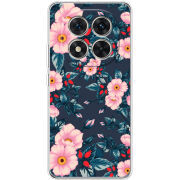 Чохол BoxFace Xiaomi Redmi Note 15 Pro 5G 