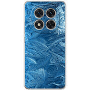 Чохол BoxFace Xiaomi Redmi Note 15 Pro 5G 