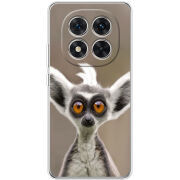 Чохол BoxFace Xiaomi Redmi Note 15 Pro 5G 