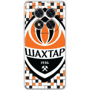 Чохол BoxFace Xiaomi Redmi Note 15 Pro 5G 