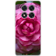 Чохол BoxFace Xiaomi Redmi Note 15 Pro 5G 