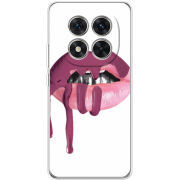 Чохол BoxFace Xiaomi Redmi Note 15 Pro 5G 