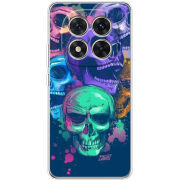 Чохол BoxFace Xiaomi Redmi Note 15 Pro 5G 