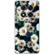 Чохол BoxFace Xiaomi Redmi Note 15 Pro 5G 