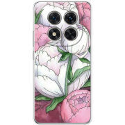 Чохол BoxFace Xiaomi Redmi Note 15 Pro 5G 