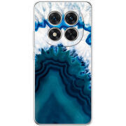 Чохол BoxFace Xiaomi Redmi Note 15 Pro 5G 