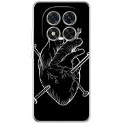 Чохол BoxFace Xiaomi Redmi Note 15 Pro 5G 