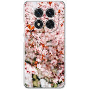 Чохол BoxFace Xiaomi Redmi Note 15 Pro 5G 