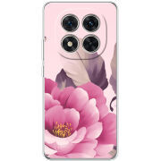 Чохол BoxFace Xiaomi Redmi Note 15 Pro 5G 