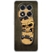 Чохол BoxFace Xiaomi Redmi Note 15 Pro 5G 