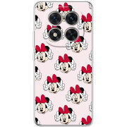 Чохол BoxFace Xiaomi Redmi Note 15 Pro 5G 