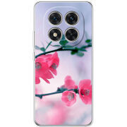 Чохол BoxFace Xiaomi Redmi Note 15 Pro 5G 