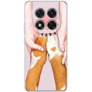 Чохол BoxFace Xiaomi Redmi Note 15 Pro 5G 