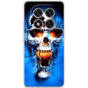 Чохол BoxFace Xiaomi Redmi Note 15 Pro 5G 