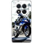 Чохол BoxFace Xiaomi Redmi Note 15 Pro 5G 