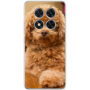 Чохол BoxFace Xiaomi Redmi Note 15 Pro 5G 