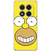 Чохол BoxFace Xiaomi Redmi Note 15 Pro 5G 