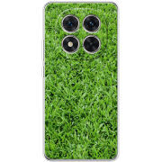 Чохол BoxFace Xiaomi Redmi Note 15 Pro 5G 