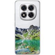 Прозорий чохол BoxFace Xiaomi Redmi Note 15 Pro 5G Green Mountain